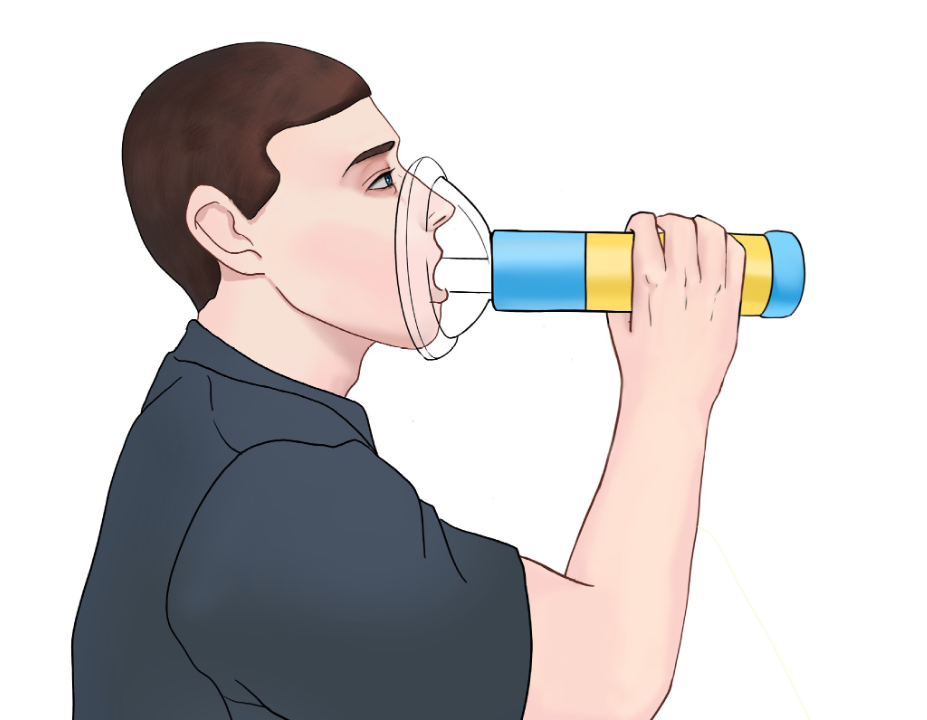 Choking Emergency Device